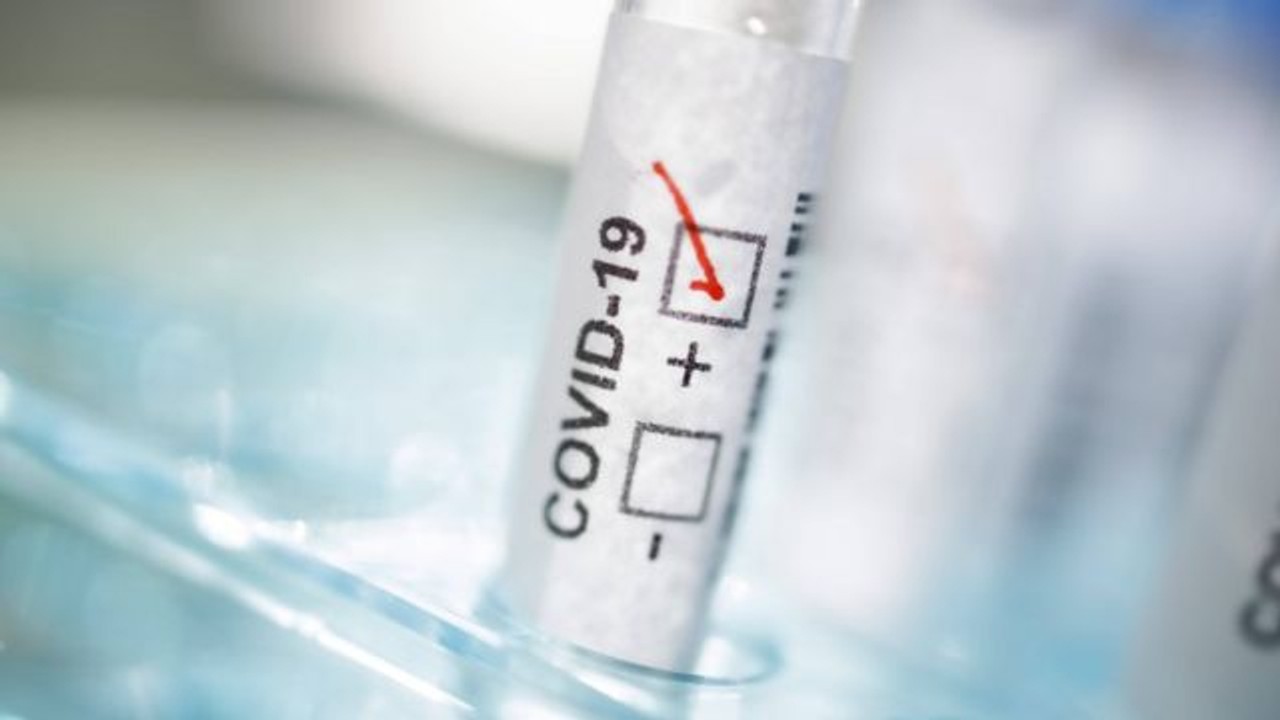 Вчені створили комбіновану тест-систему для коронавируса і грипу