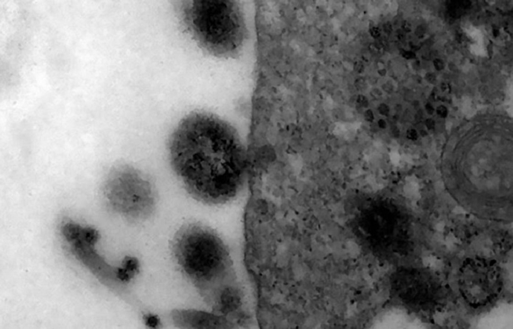 У Росії виявлено близько 10 тисяч нових випадків коронавируса, майже третина з них - в Москві