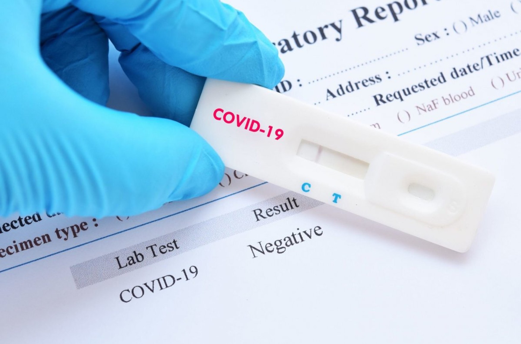 Москвичі з симптомами ГРВІ тепер будуть здавати експрес-тести на коронавірус