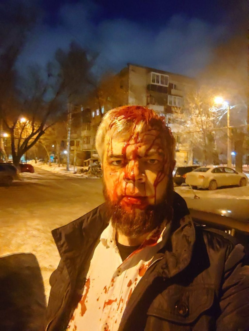 В Челябинске избили адвоката, который ведет дела, связанные с депутатом от «ЕР» и администрацией в области